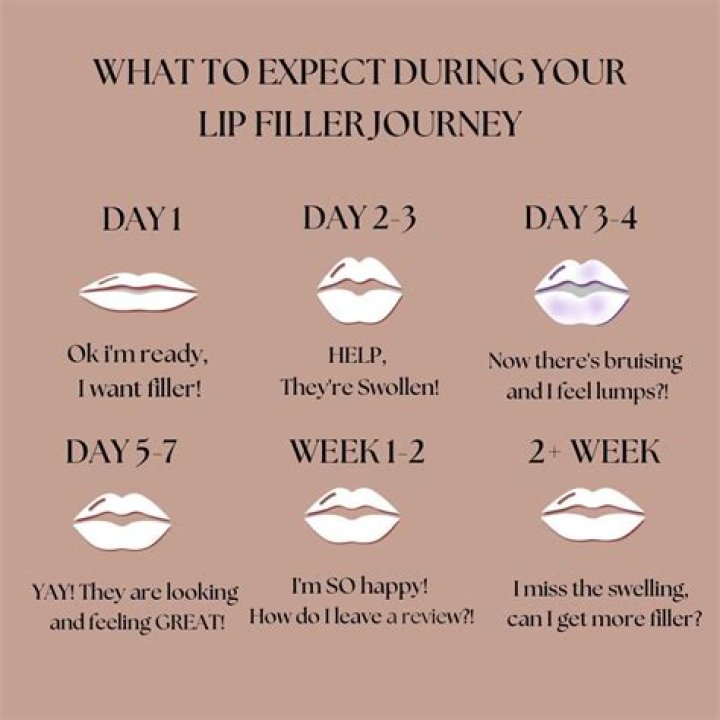 Exploring the Allure of Florence Pugh's Lip Filler Journey