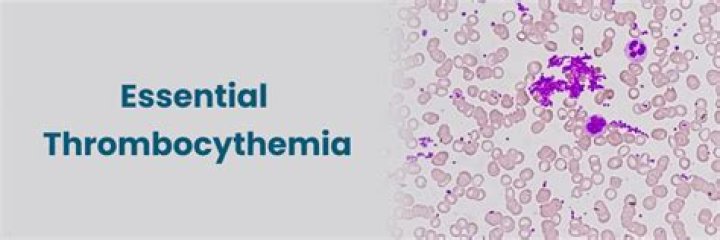 Famous Faces Battling Essential Thrombocythemia