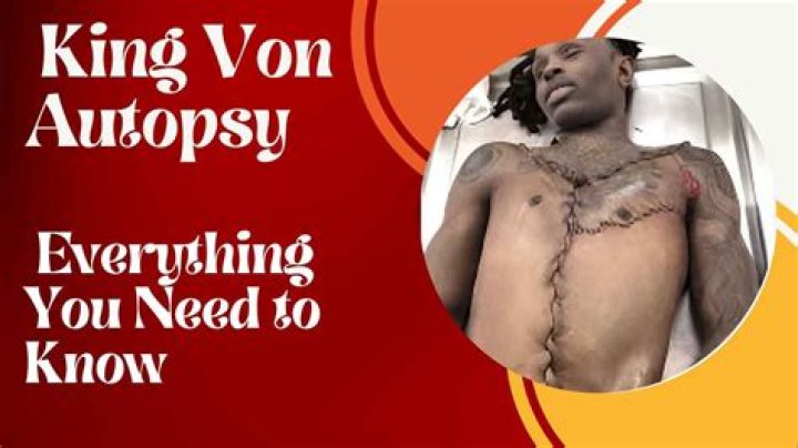 King Von Autopsy Released: A Deep Dive into the Controversial Case